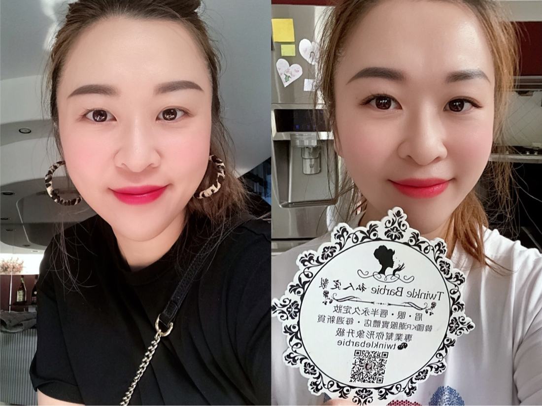 前后对比