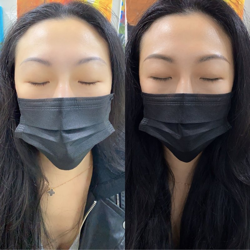 前后对比